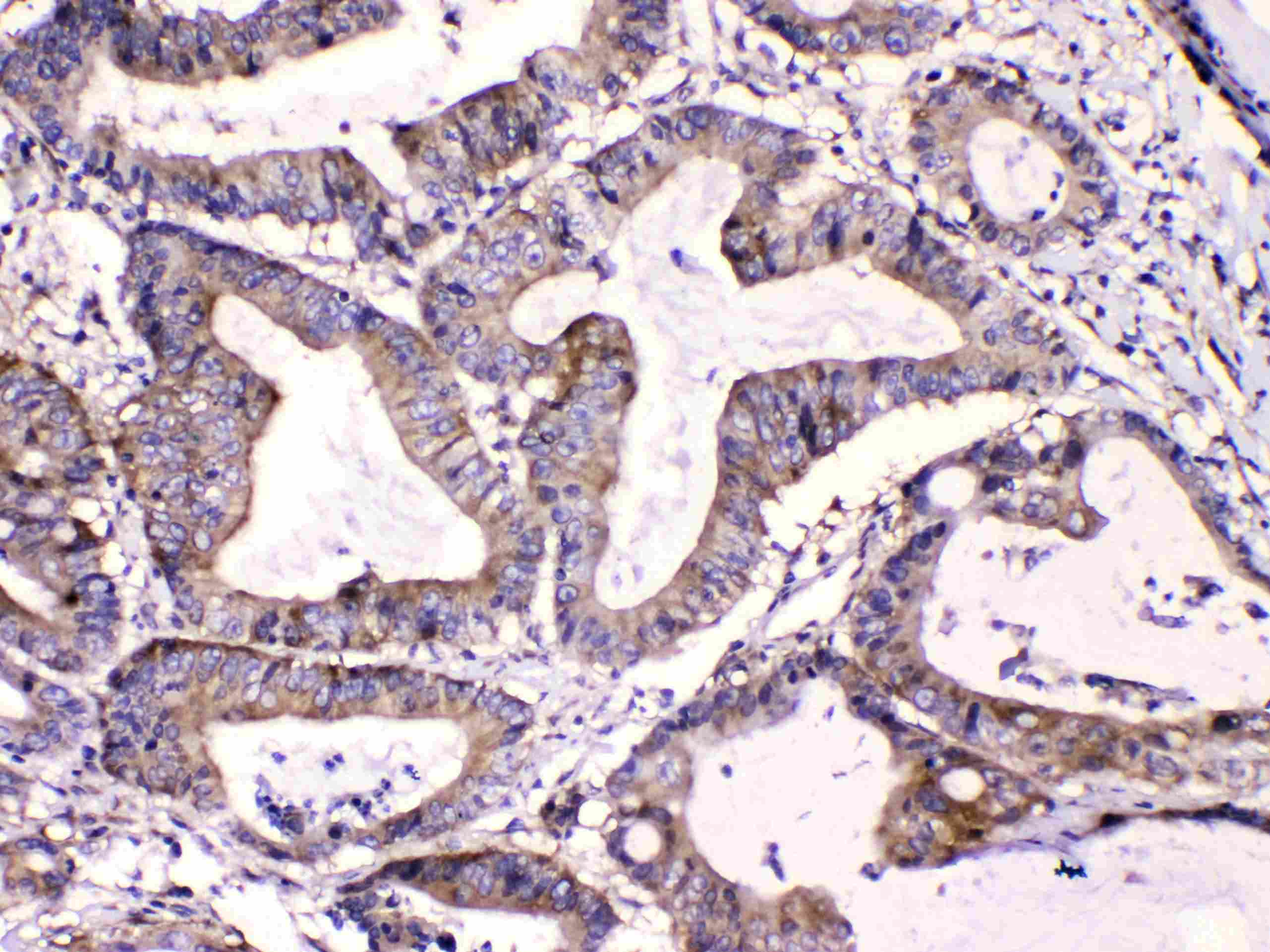 Polyclonal Rabbit anti-Human CAST / Calpastatin Antibody (IHC, WB)