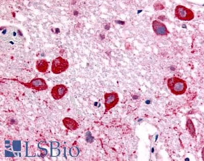 PathPlus™ Polyclonal Rabbit anti-Human CHRM2 / M2 Antibody (Cytoplasmic Domain, IHC)
