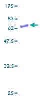 Human SULT1B1 / Sulfotransferase 1B1 Protein (Recombinant GST)