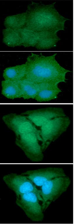 PARK7 / DJ-1 Antibody (clone AT1E12)