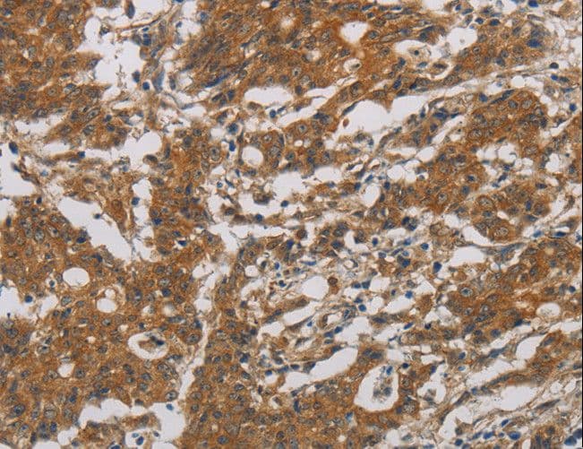 CNDP1 Antibody