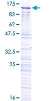 Human SRPK2 Protein (Recombinant GST)