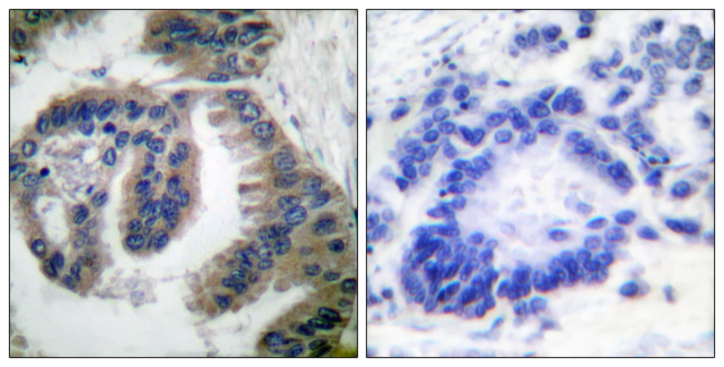 Polyclonal Rabbit anti-Human DNAJB1 / Hsp40 Antibody (aa271-320, IHC, IF, WB)