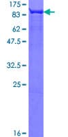Human FUBP1 Protein (Recombinant GST)
