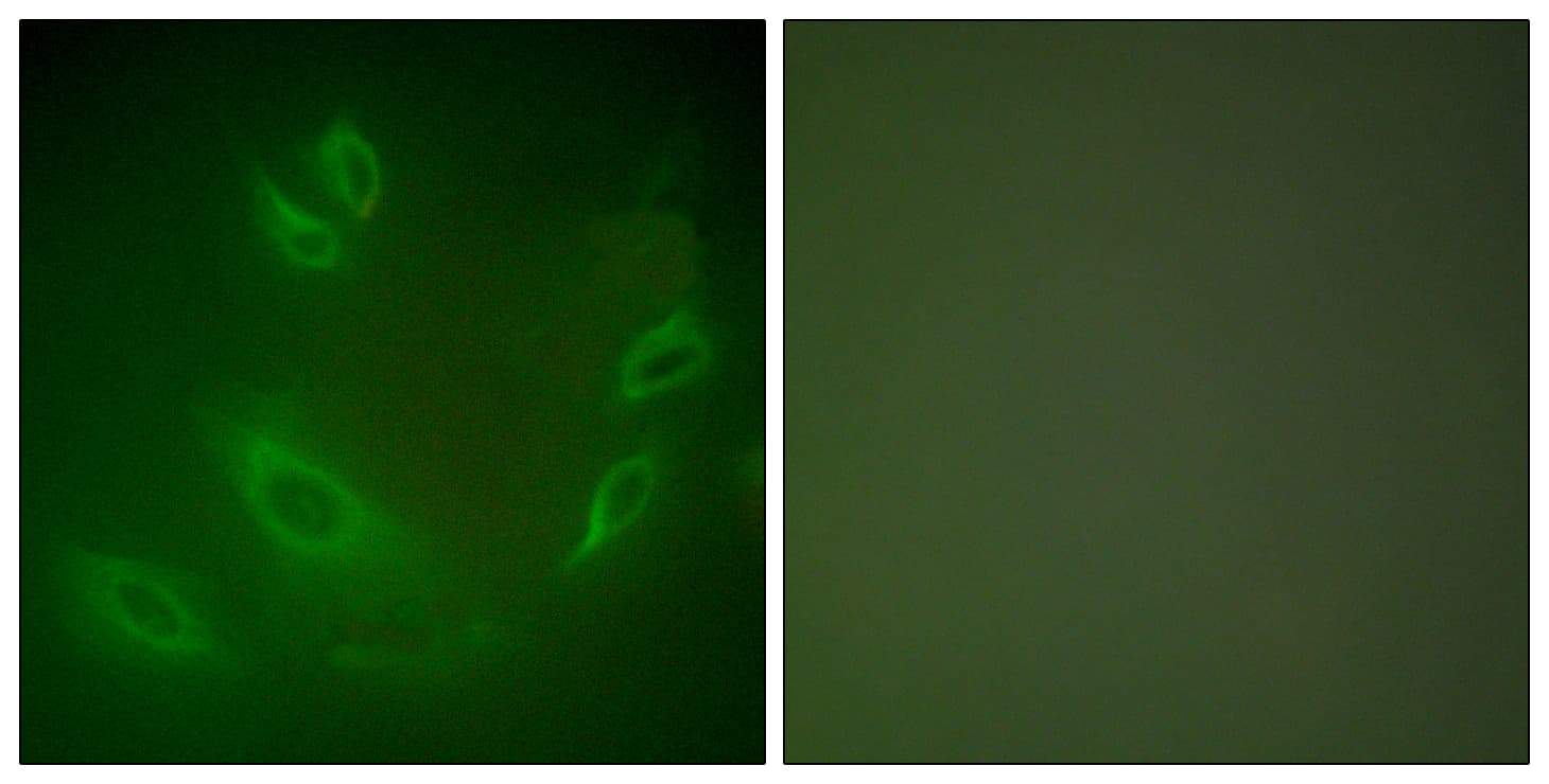 IHC-plus™ HSPH1 / HSP105 Antibody (aa791-840)