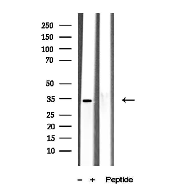 Polyclonal Rabbit anti-Human PEG1 / MEST Antibody (IHC, IF, WB)