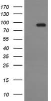 IHC-plus™ CDH3 / P-Cadherin Antibody (clone 2D5)
