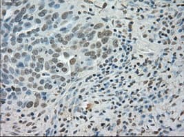 SATB1 Antibody (clone OTI13D6)