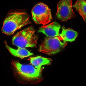 Monoclonal Mouse anti-Human SLC2A4 / GLUT-4 Antibody (clone 3G10A3, aa224-353, IHC, IF, WB)