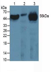 FGB / Fibrinogen Beta Chain Antibody (PE)