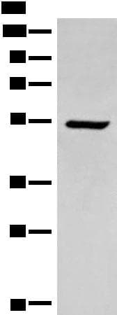 ACD / PTOP Antibody