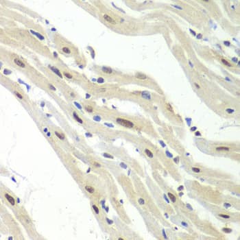 RENT1 / UPF1 Antibody