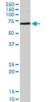 MAPKAPK2 / MAPKAP Kinase 2 Antibody (clone 3B8)