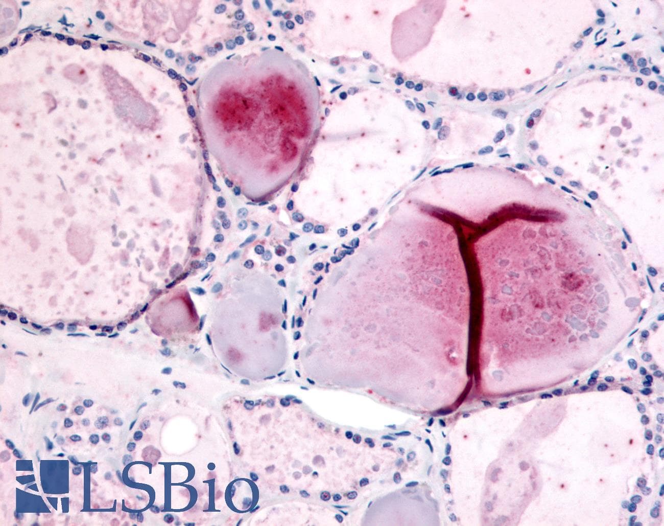 IHC-plus™ PDE8B Antibody (Internal)