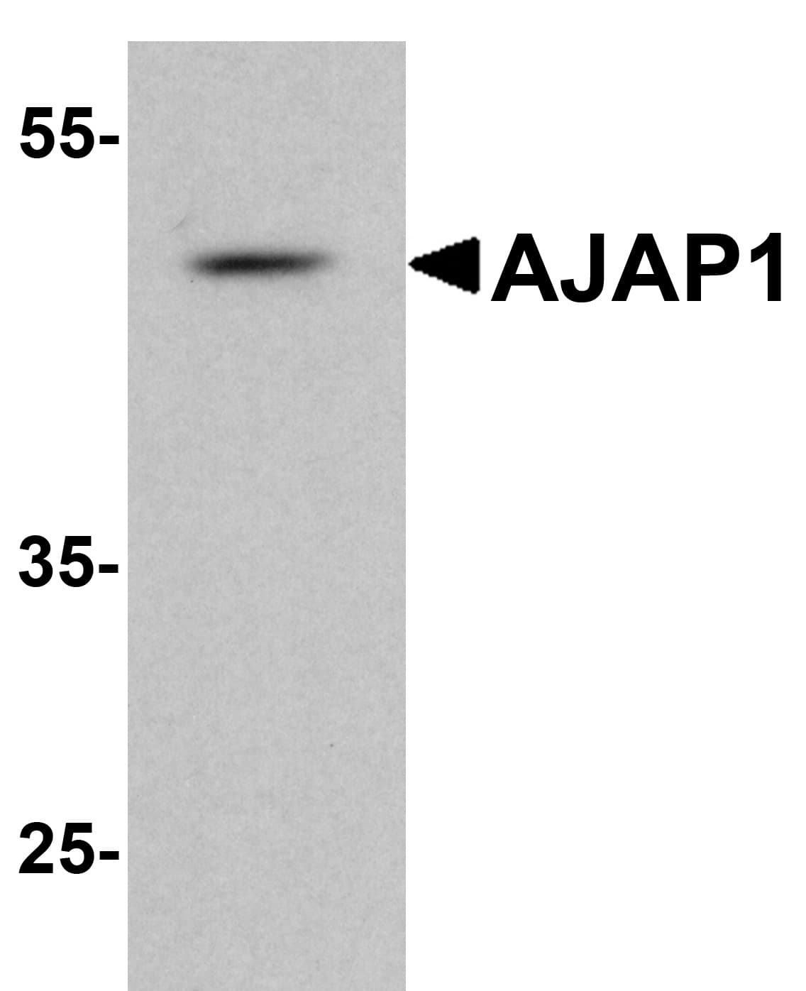 IHC-plus™ SHREW-1 / AJAP1 Antibody