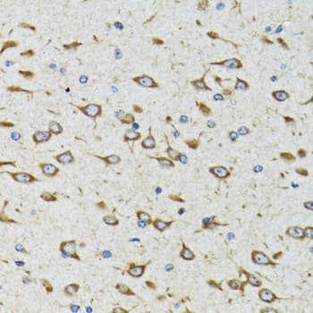 Polyclonal Rabbit anti-Human AKTIP / FTS Antibody (IHC, WB)