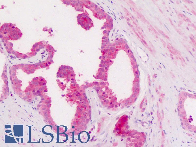 IHC-plus™ Polyclonal Rabbit anti-Human ITGAX / CD11c Antibody (Internal, IHC)
