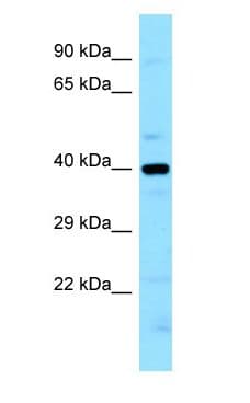 LIMS2 Antibody (aa101-150)