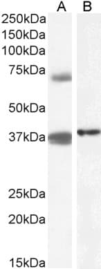 IHC-plus™ TRIM29 Antibody (aa295-306)
