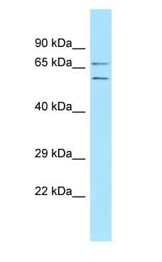 ECM2 Antibody (N-Terminus, FITC)