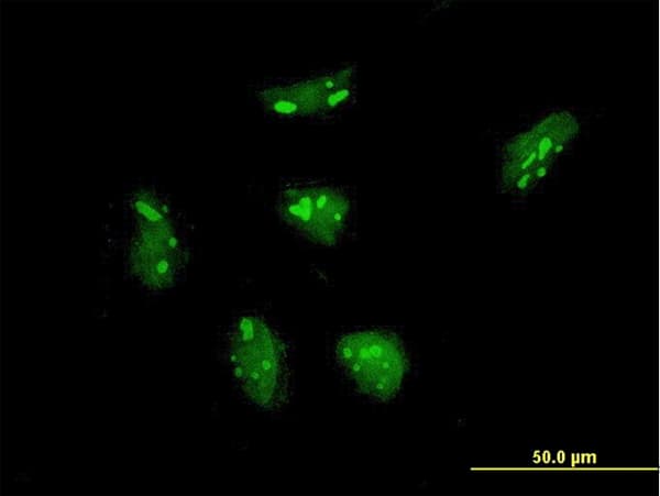 RPL21 / Ribosomal Protein L21 Antibody (clone 2D8)