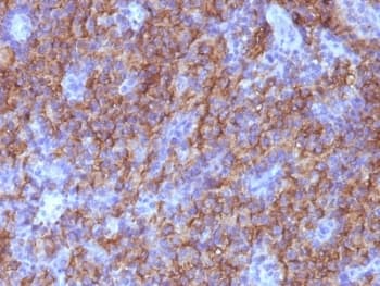 CHGA / Chromogranin A Antibody (clone CHGA/765, Ready-to-Use)