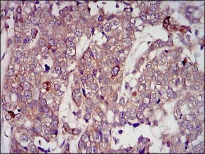 IGF2 Antibody (Amino Acid: 25-180, clone 8H1)