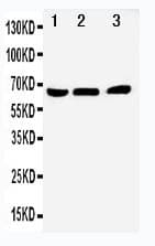 NR4A1 / NUR77 Antibody (aa99-112)