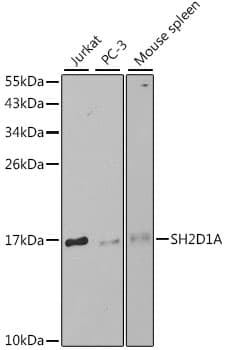 IHC-plus™ SH2D1A / SAP Antibody