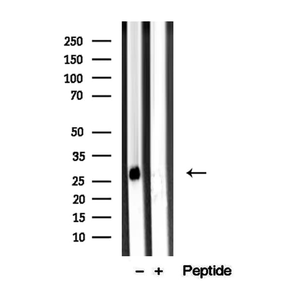 Polyclonal Rabbit anti-Human ARHGDIB / D4 GDI Antibody (IHC, IF, WB)