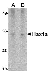 IHC-plus™ Monoclonal Mouse anti-Human HAX-1 Antibody (clone 9G6C6, IHC, WB)