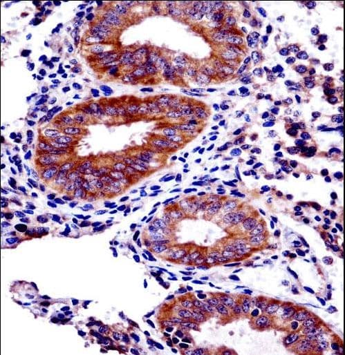 JADE3 / PHF16 Antibody (aa779-806)