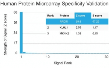 RAD51 / RECA Antibody (clone RAD51/2765)
