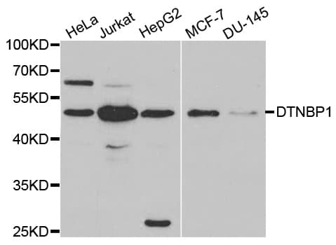 DTNBP1 / Dysbindin Antibody