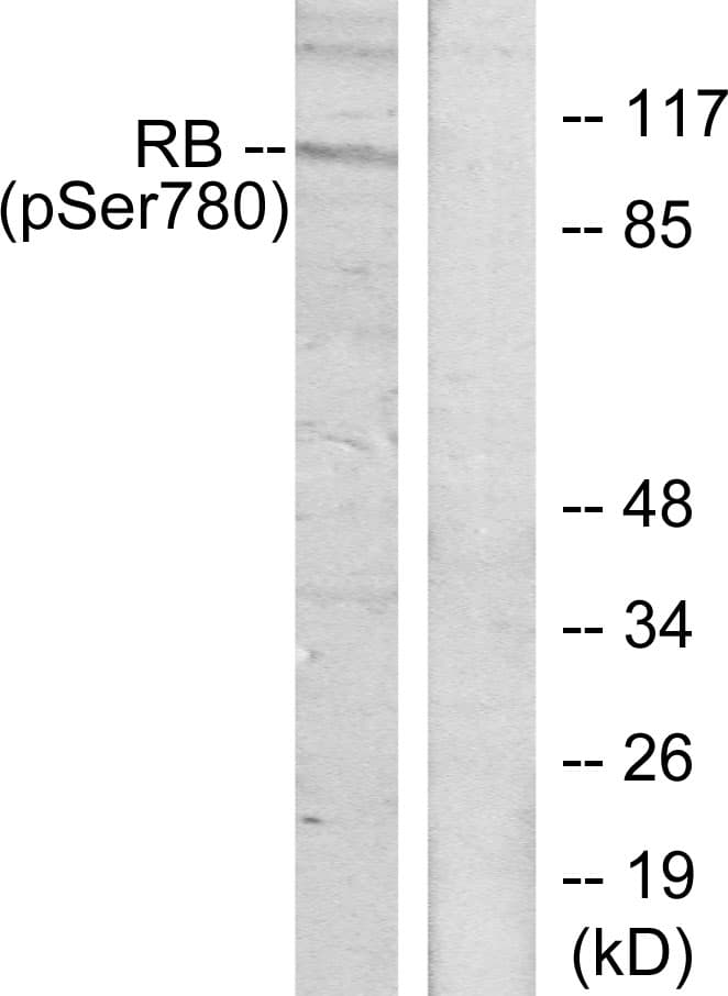 Polyclonal Rabbit anti-Human RB1 / Retinoblastoma / RB Antibody (phospho-Ser780, IHC, WB)