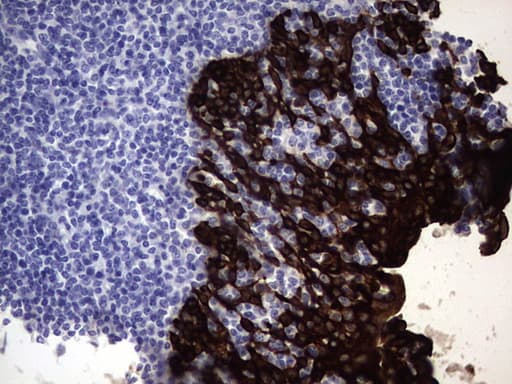 KRT19 / CK19 / Cytokeratin 19 Antibody (aa240-390, clone OTI5G7)