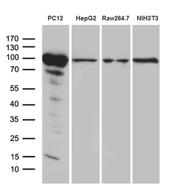 PYGM Antibody (aa698-842, clone OTI5D1)
