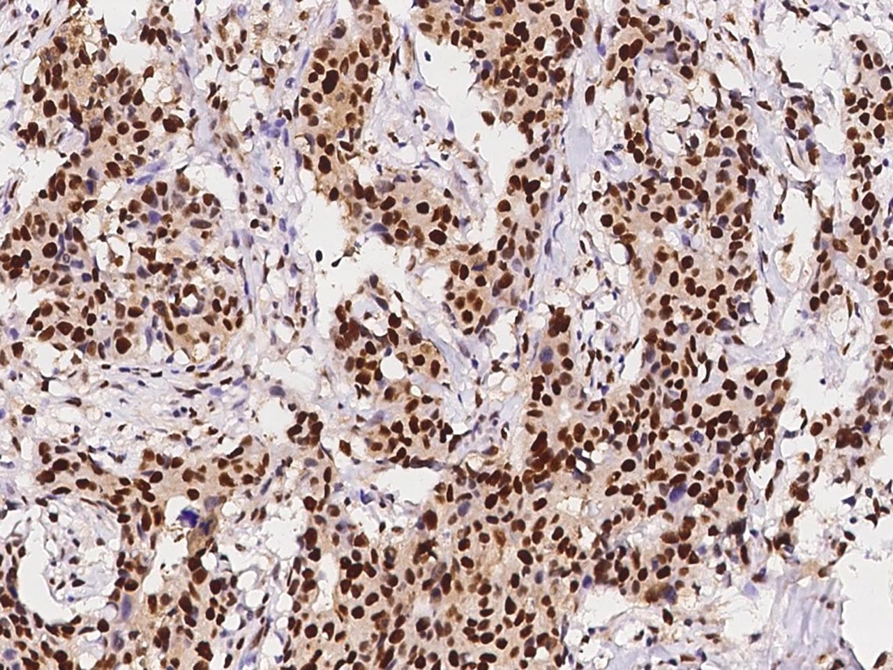 Monoclonal Rabbit anti-Human PCNA Antibody (clone 144, Preservative Free, IHC)