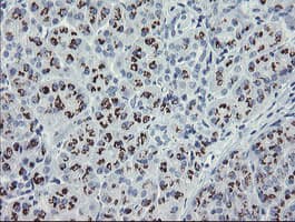 THAP6 Antibody (clone OTI5G2)