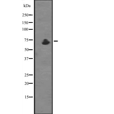 ZDHHC17 Antibody