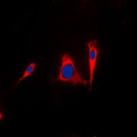 YWHAG / 14-3-3 Gamma Antibody (Internal)