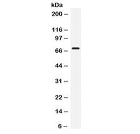 PLAP / Alkaline Phosphatase Antibody