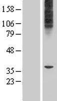 MFSD6L Protein (Over-Expression Lysate Myc-DDK (Flag))