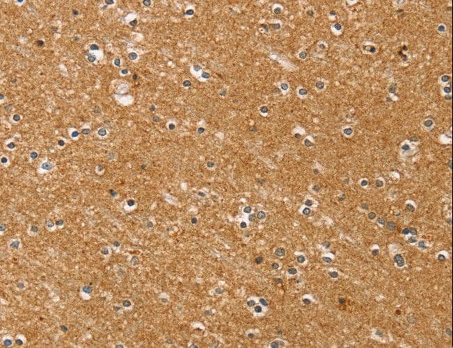 SYTL5 Antibody