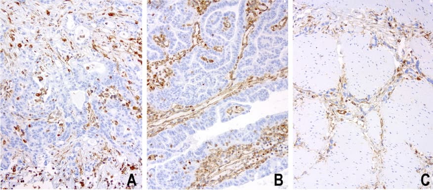 Monoclonal Mouse anti-Human Vimentin Antibody (clone UMAB160, IHC, IF, WB)