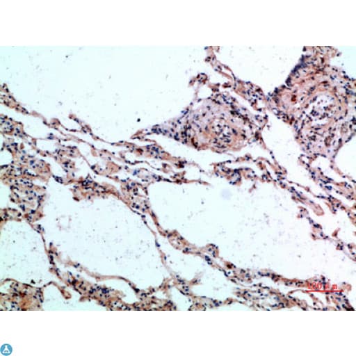 Polyclonal Rabbit anti-Human CTGF Antibody (IHC)