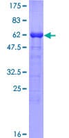 Human ADRM1 Protein (Recombinant GST)