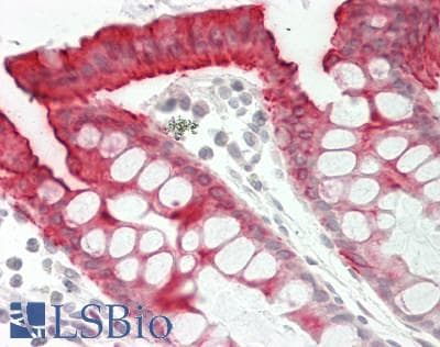 IHC-plus™ CO-029 / TSPAN8 Antibody (Internal)