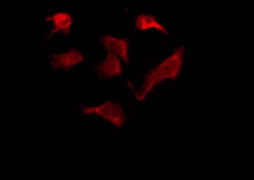OR6Q1 Antibody