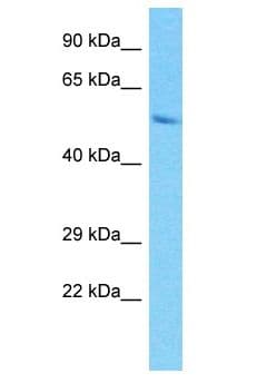 PRAMEF9 Antibody (aa242-291)